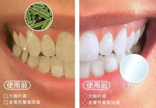 牙黄口臭有救了 清除99%口腔有害菌，说话都是花香味